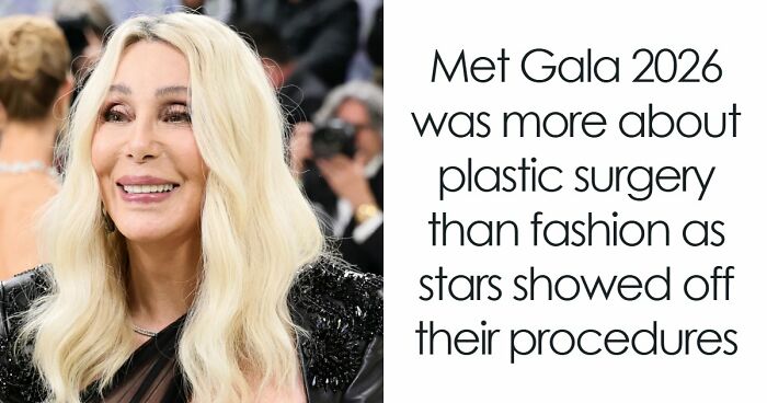 Met Gala 2026 Was More About Plastic Surgery Than Fashion As Stars Showed Off Their Procedures
