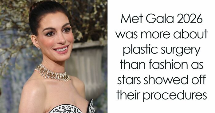 Met Gala 2026 Was More About Plastic Surgery Than Fashion As Stars Showed Off Their Procedures