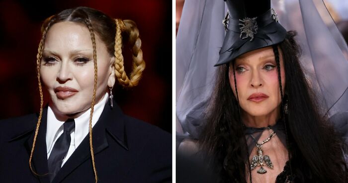 Met Gala 2026 Was More About Plastic Surgery Than Fashion As Stars Showed Off Their Procedures