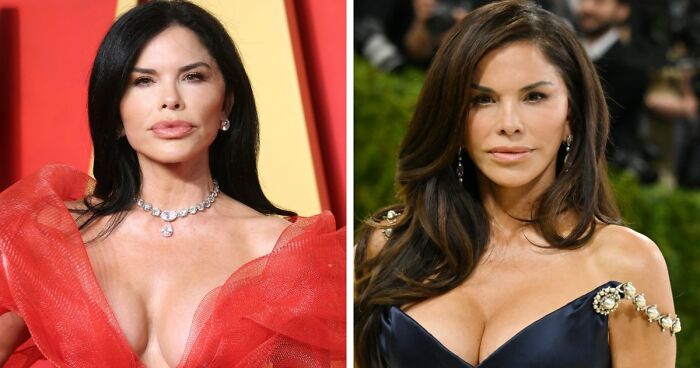 Met Gala 2026 Was More About Plastic Surgery Than Fashion As Stars Showed Off Their Procedures