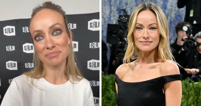 Met Gala 2026 Was More About Plastic Surgery Than Fashion As Stars Showed Off Their Procedures