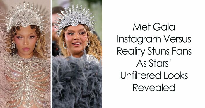 Met Gala 2026 Was More About Plastic Surgery Than Fashion As Stars Showed Off Their Procedures