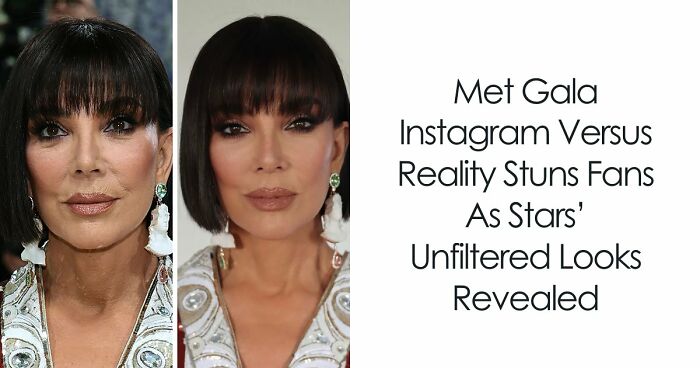 Met Gala 2026 Was More About Plastic Surgery Than Fashion As Stars Showed Off Their Procedures
