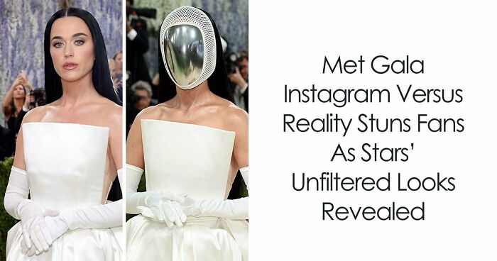 Met Gala 2026 Was More About Plastic Surgery Than Fashion As Stars Showed Off Their Procedures