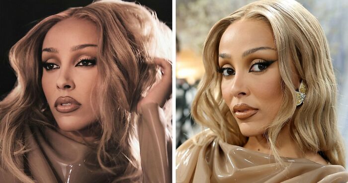 Met Gala 2026 Was More About Plastic Surgery Than Fashion As Stars Showed Off Their Procedures