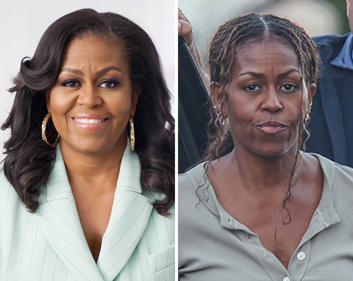 Side-by-side comparison of Michelle Obama healthy and gaunt appearance