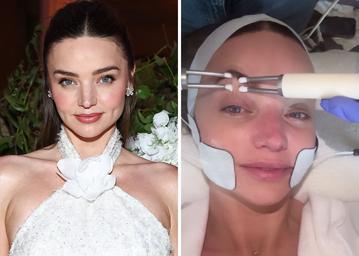 Woman on left in white gown, smiling. Woman on right undergoing a plastic surgery procedure on her face.