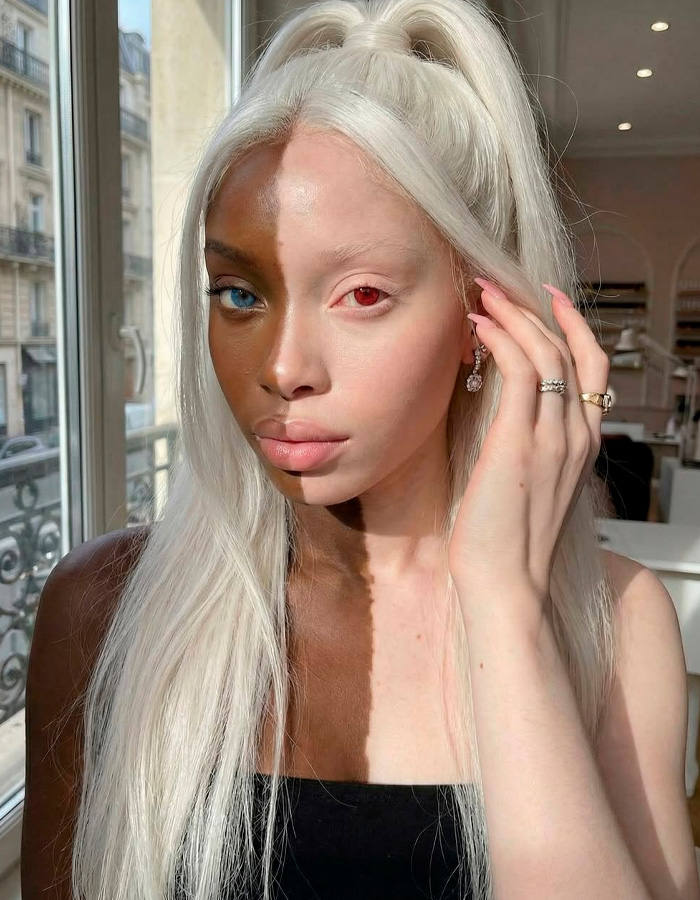 Close-up of model showing unique half dark and half light skin coloration