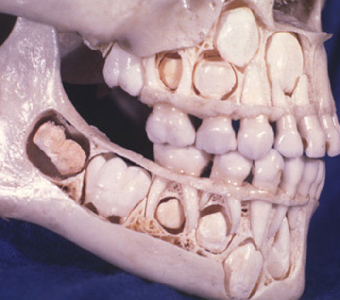 Cross-section of human skull showing developing teeth inside jaw bones