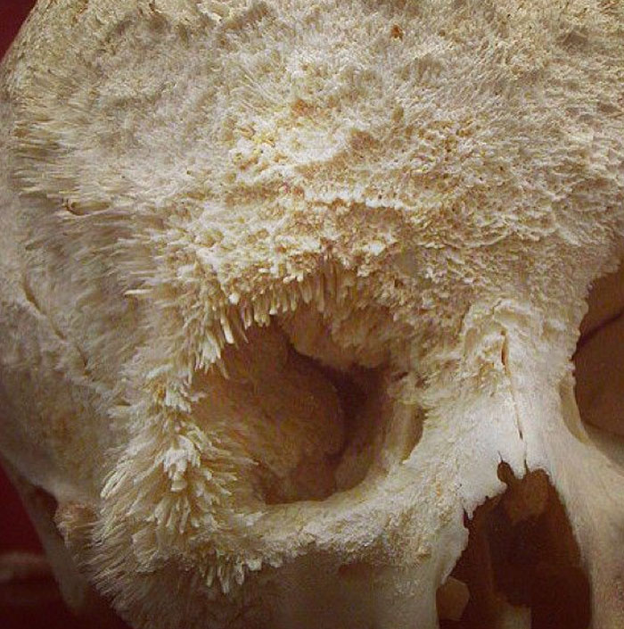 Close-up of skull covered in white crystalline substance