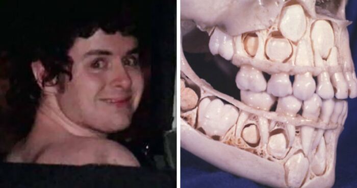 58 Safe For Work Images That Are Highly Disturbing