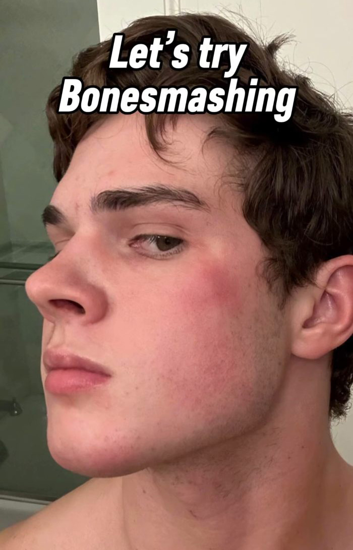 Young man demonstrating bonesmashing for looksmaxxing on face