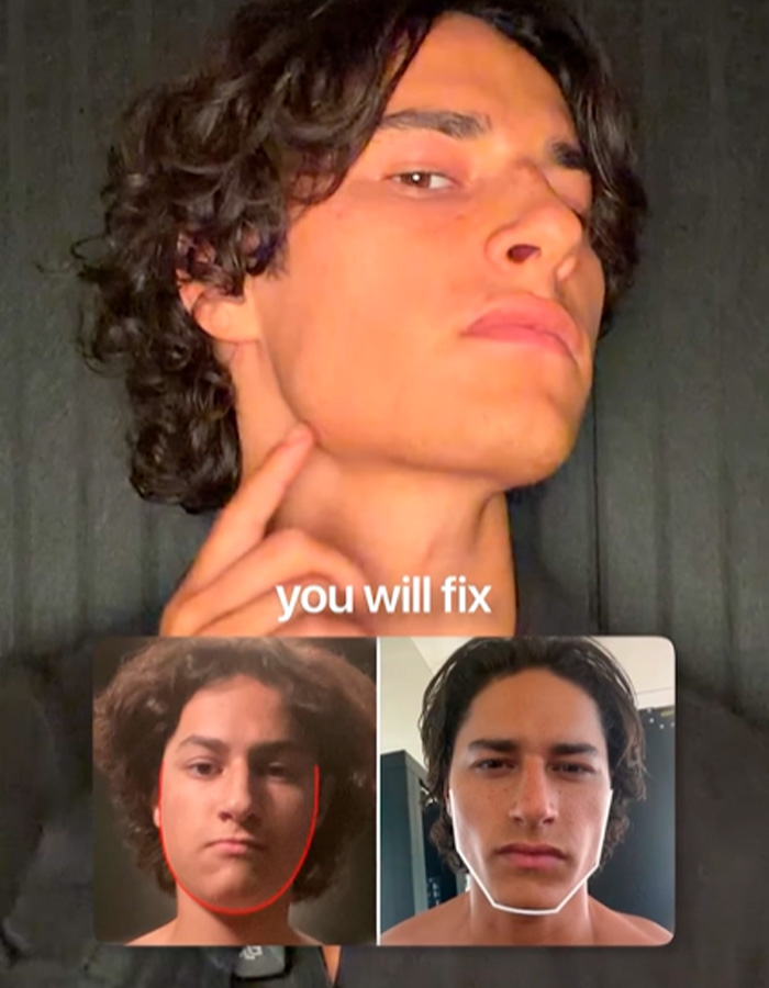 Before and after face structure fixes with looksmaxxing
