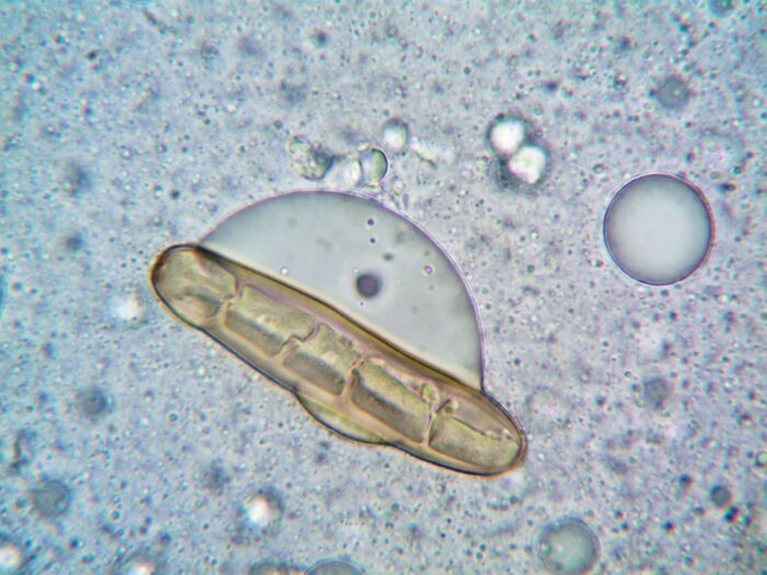 Microscopic view of a parasite egg under the microscope