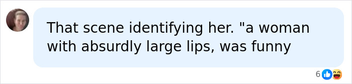 Chat message about a woman with absurdly large lips, mentioning lip filler