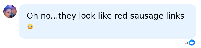 Comment comparing lip filler results to red sausage links