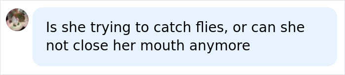 Question about lip filler effects causing inability to close mouth
