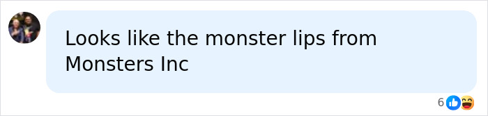 Chat message comparing lips to monster lips from Monsters Inc in lip filler context