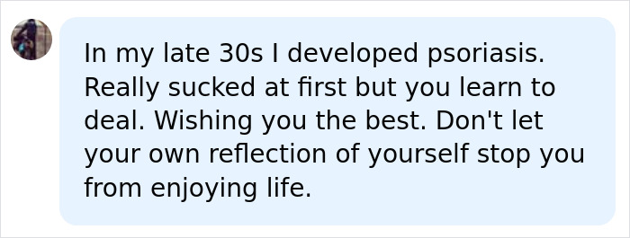 Screenshot of a social media comment: a person in their late 30s developed psoriasis and offers support for a teen with skin condition.