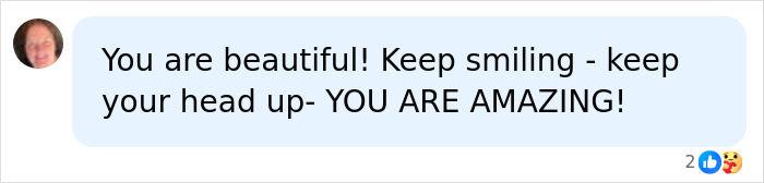 A supportive comment from an online user stating, "You are beautiful! Keep smiling - keep your head up- YOU ARE AMAZING!" for a teen with skin condition.