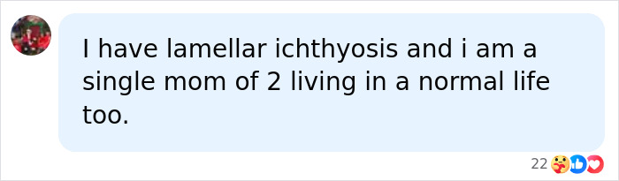 A person's online comment discussing their skin condition, lamellar ichthyosis, and living a normal life. This relates to a teen with a rare skin condition.