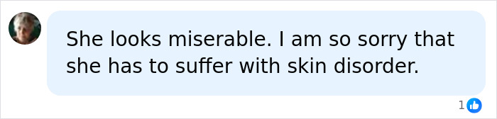 A social media comment showing sympathy for a teen with a rare skin condition, expressing sorrow for her struggles online.