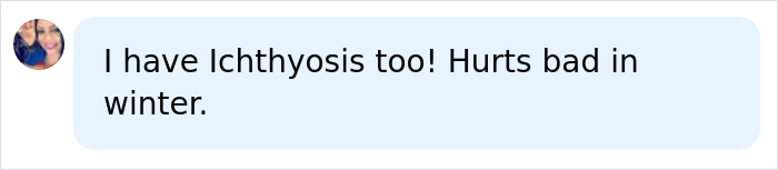 A social media comment from a user saying, I have Ichthyosis too! Hurts bad in winter. A rare skin condition.