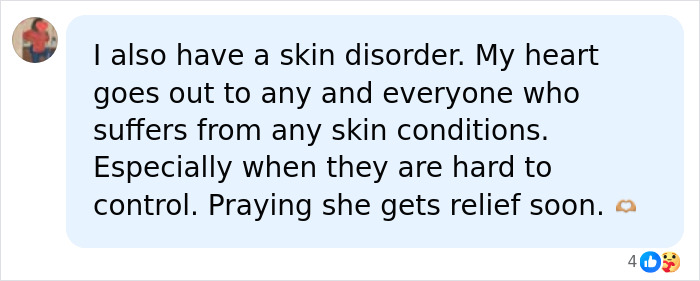 Teen With An Extremely Rare Skin Condition Talks About Her Struggles Online, Ends Up Going Viral
