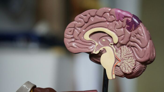 A human brain model, sectioned to show internal structures. This image is related to disturbing d***h stories.