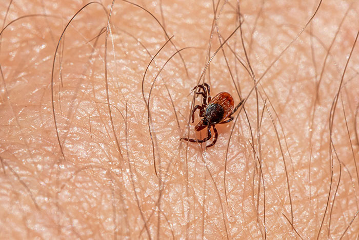 Tick crawling on human skin representing freaky scientific facts about parasites