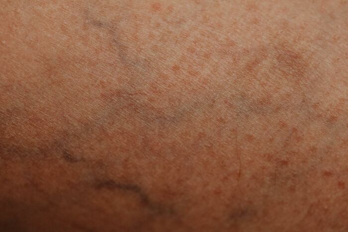 Close-up of human skin with visible pores and veins. A common subject for debunking outdated facts.