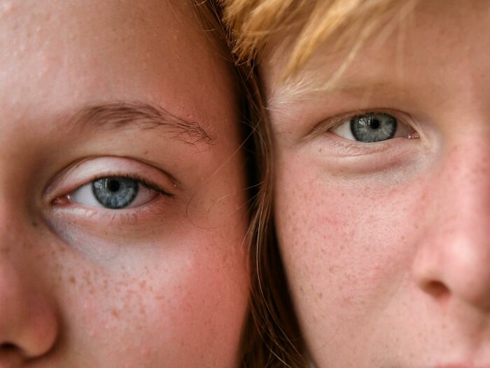 Close-up of two young people's eyes with blue irises and freckles, representing outdated facts and how they persist.