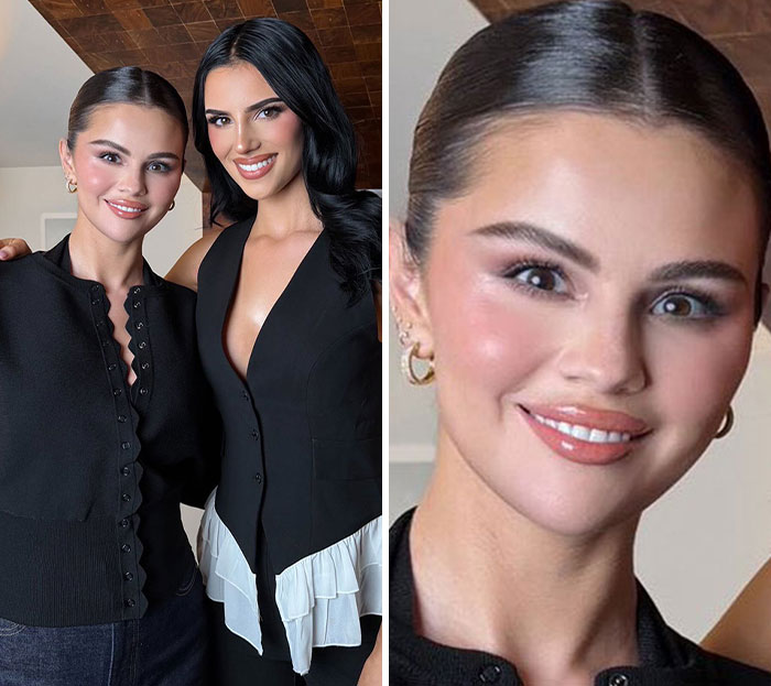 Nova foto de Selena Gomez revela cirurgia plástica surpreendente, afirmam fãs