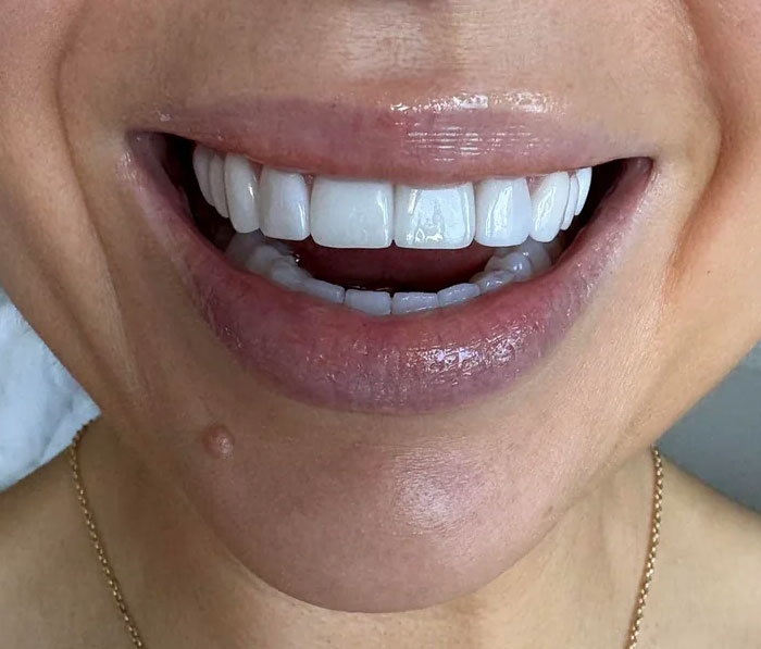 Close up of smiling mouth with white teeth dental beauty lies uncovered