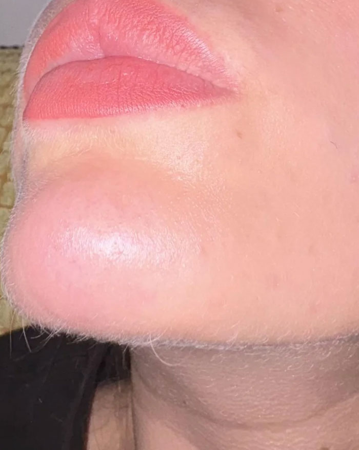 Close-up of smooth lips and chin with natural skin texture beauty feature