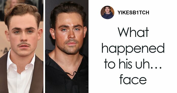 Jack Osbourne Breaks Silence On Being Bullied “Fat And Skinny” After Family’s Transformations Face Scrutiny