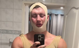 Looksmaxxer Androgenic Fights Flight Attendant And Gets Kicked Off Plane Shortly After Getting Plastic Surgery