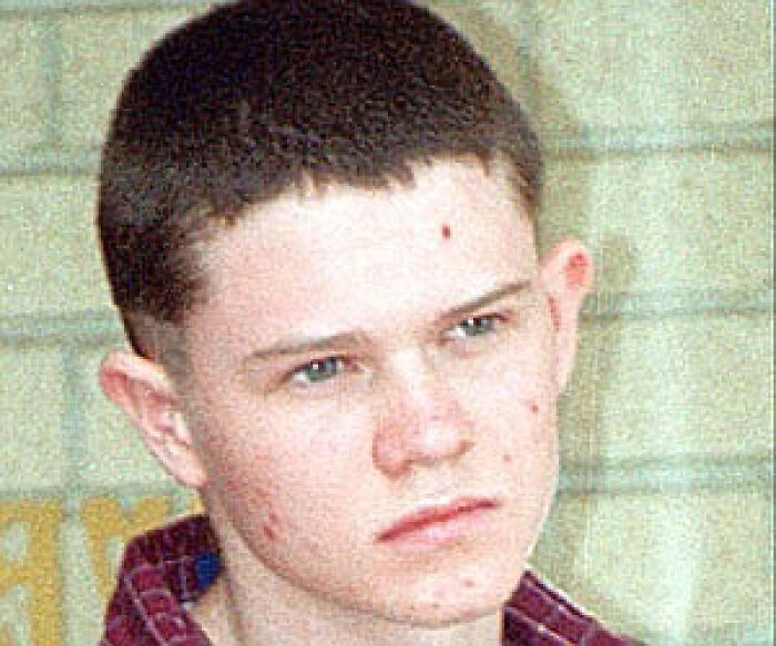 Close-up creepy photo of a young man with an intense expression and blemished face