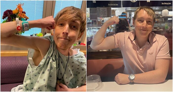 Before and after photos of hospital patient showing strength