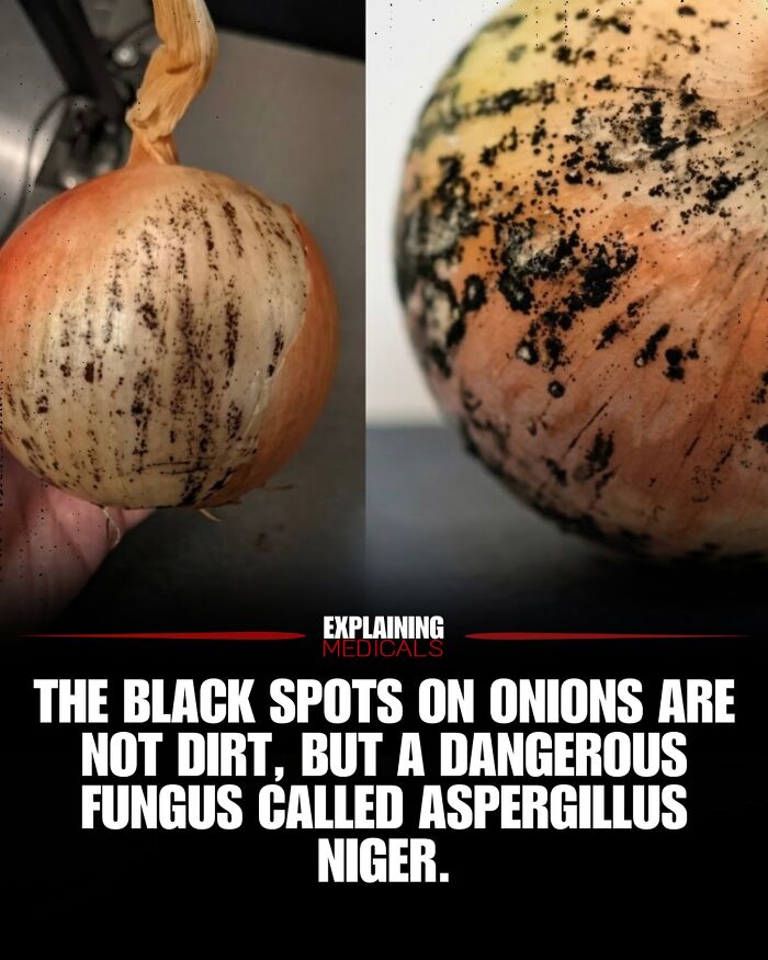 Onions showing black spots caused by dangerous Aspergillus n***r fungus, not dirt