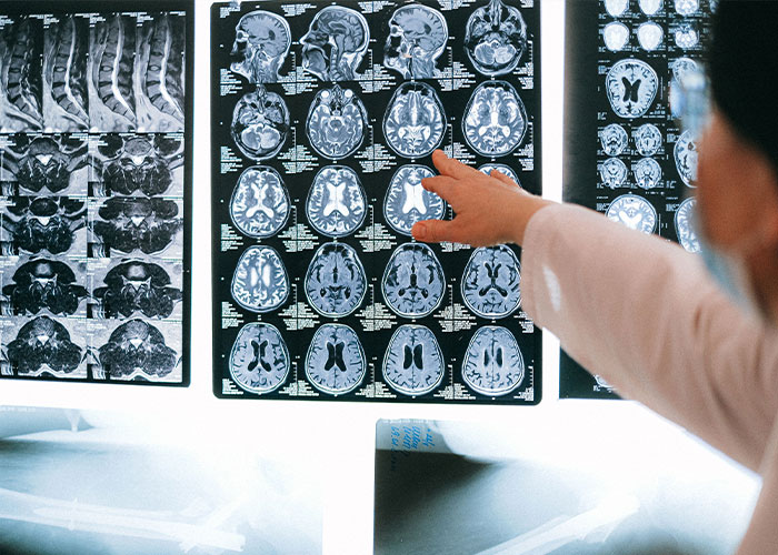 A doctor pointing to brain MRI scans, illustrating new research on brain triggers and how we understand autism. A doctor pointing to brain MRI scans, illustrating new research on brain triggers and how we understand autism.