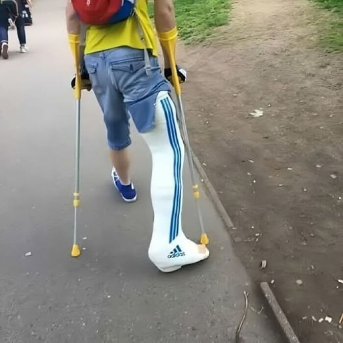 A person with one leg in a full-length cast and using crutches, showing examples of Slavic Science.