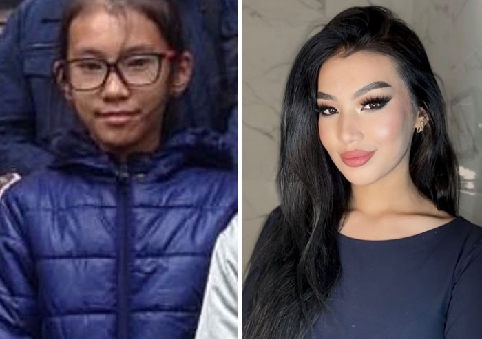 An ugly duckling transformation showcasing a young girl with glasses transforming into a stunning woman, highlighting her self-love journey.