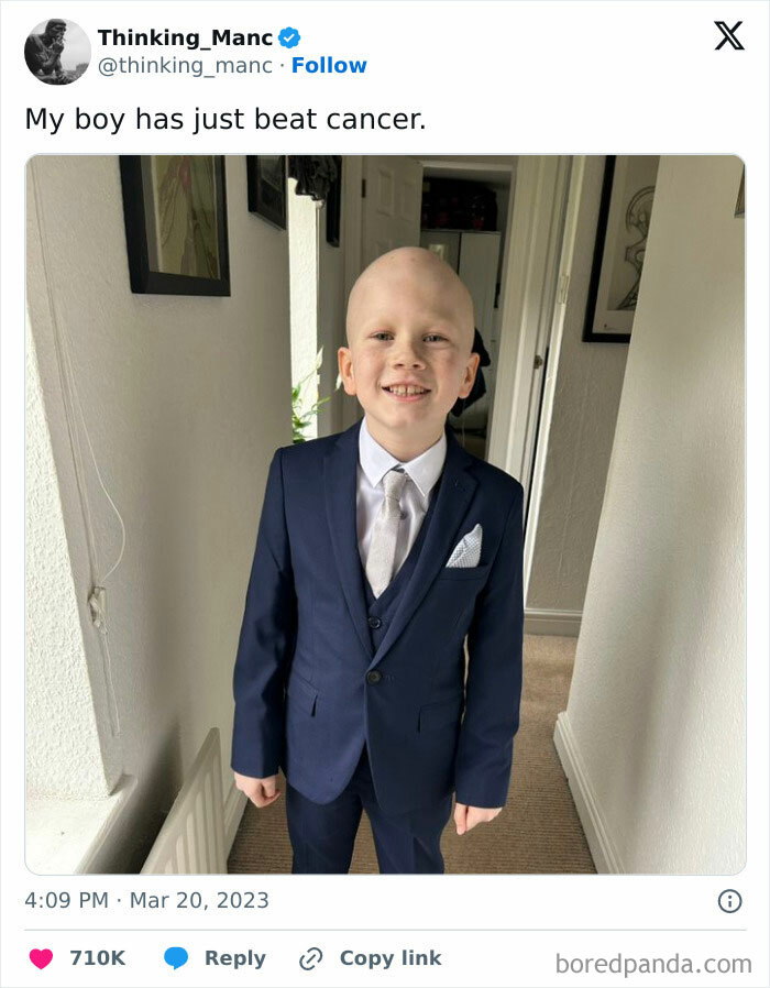 Soul-healing triumph: A young boy, bald and smiling, stands in a suit after beating cancer.