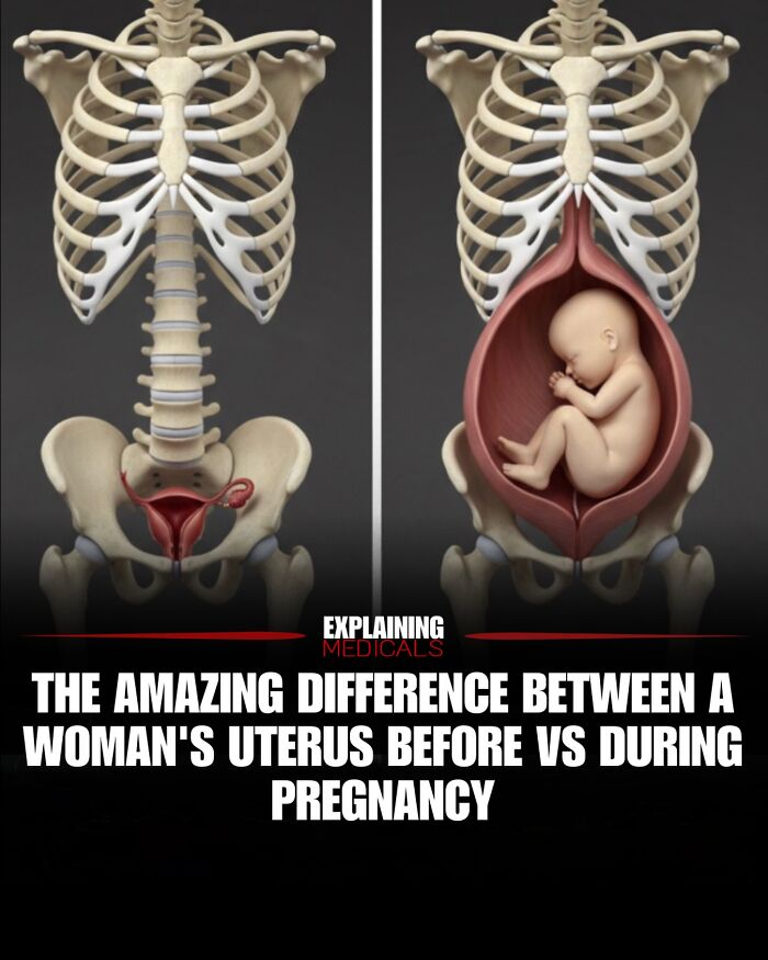 Medical illustration comparing a woman's uterus before and during pregnancy