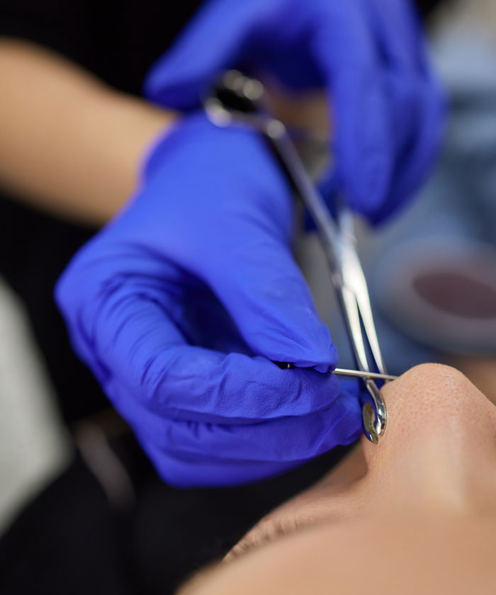 Gloved hands holding tool near nose during body-related procedure