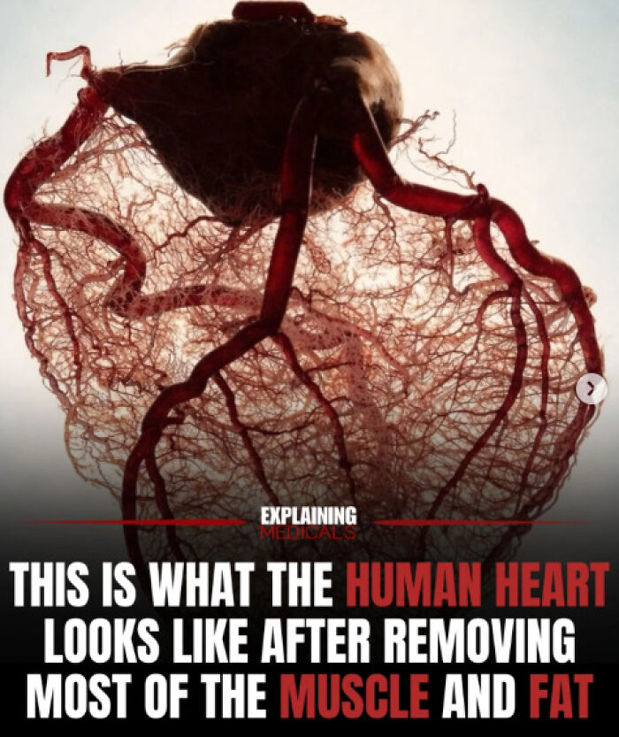 Human heart after removing most muscle and fat showing blood vessels