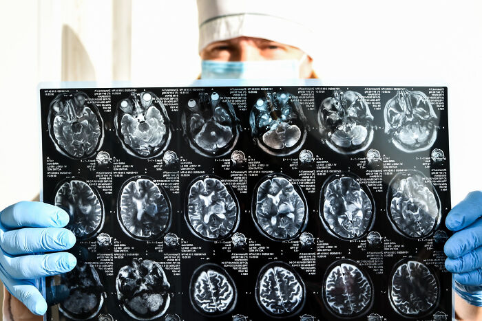 Medical professional examining human brain MRI scans