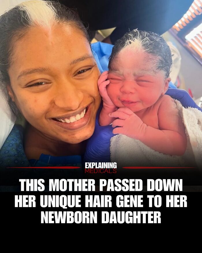 Mother and newborn daughter both have unique white hair gene in health facts image