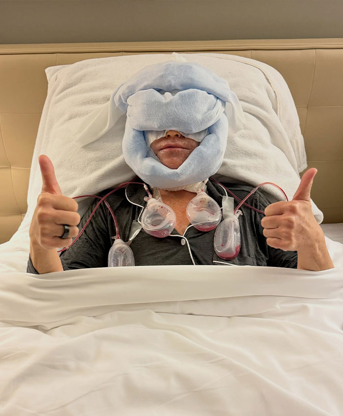 Patient recovering from plastic surgery with face wrapped in bandages giving thumbs up
